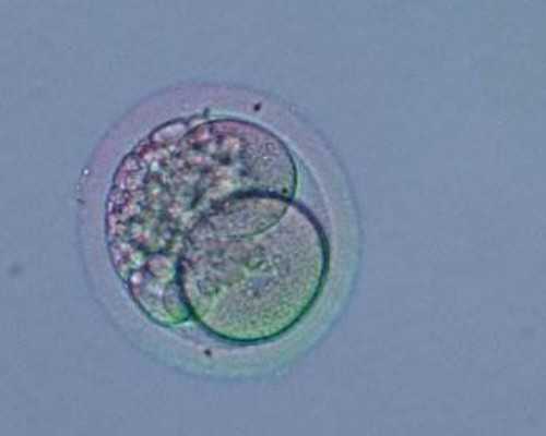 卵巢囊肿会影响排卵吗？~试管代妈哪里好